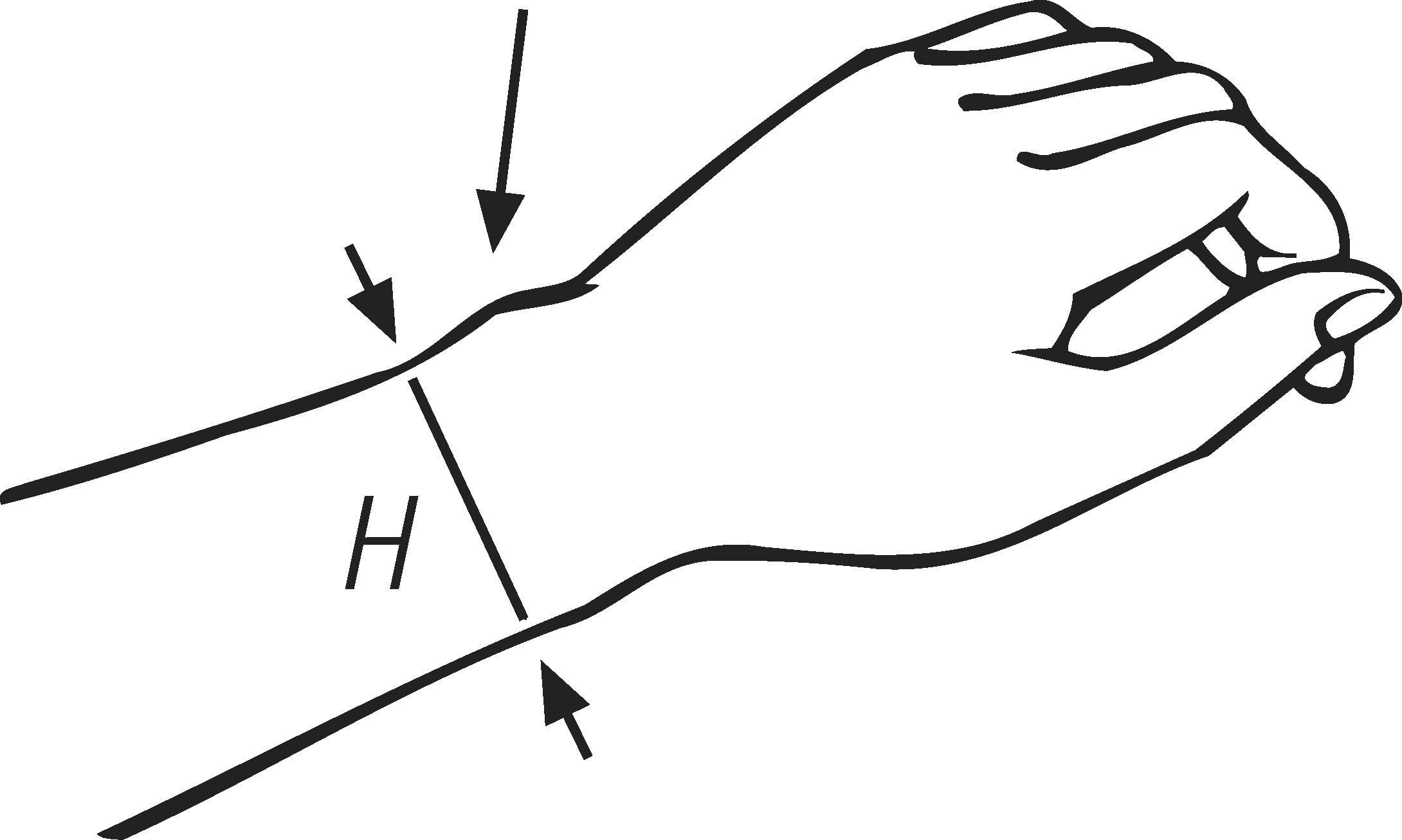 BORT Generation duimbandage